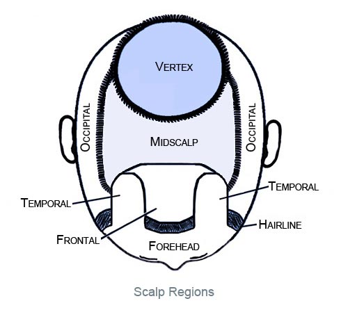 Figure8_Scalp_Regions_Bekki