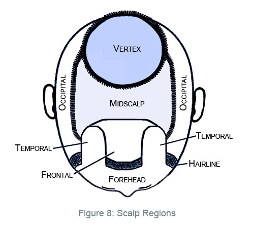Figure8_Scalp_Regions_Bekki