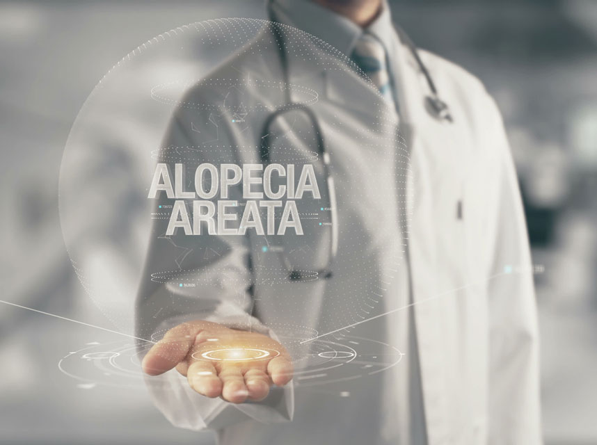 Causes and Risk Factors for Alopecia Areata (AA) There are many different conditions that may cause patchy hair loss, but there is also evidence alopecia areata is an auto-immune condition.
