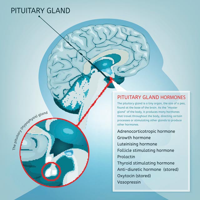 Cushing Disease & Cushing Syndrome Cushing disease is caused by noncancerous tumors in the pituitary gland.