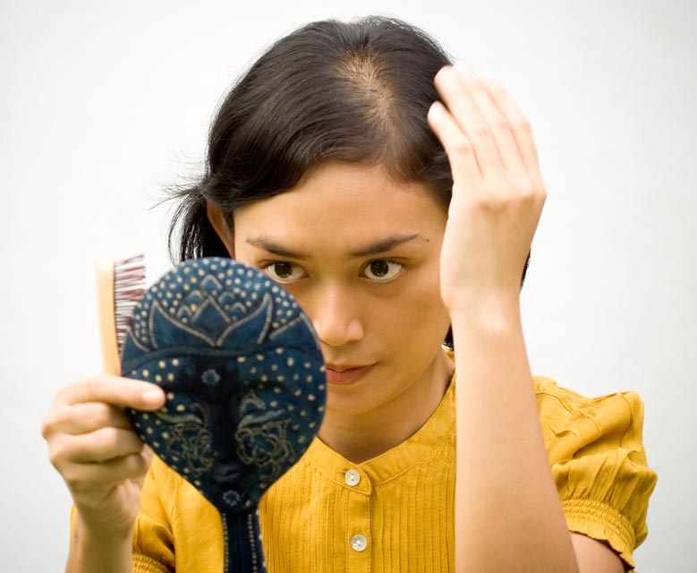 Female Pattern Hair Loss and Heredity Female patterned hair loss can be caused by genetics.