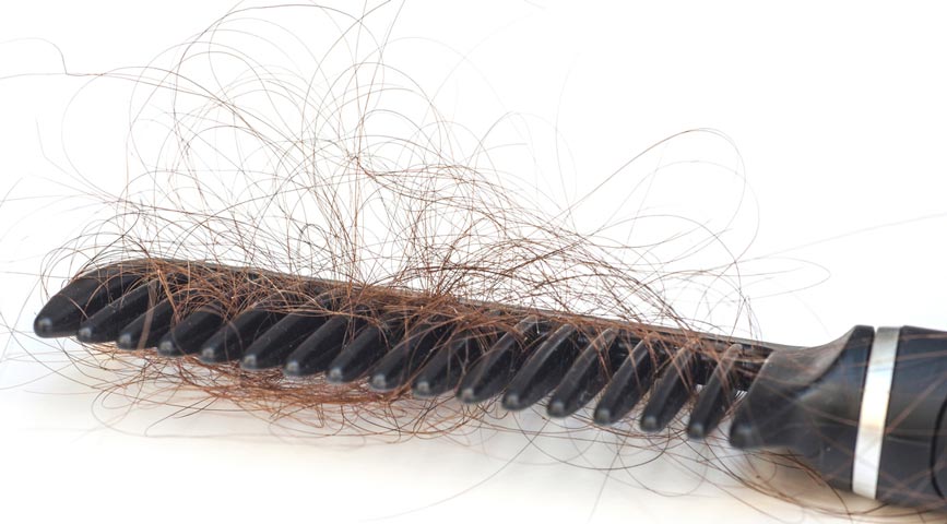 Amount of Hair Shedding What is a normal amount of hair shedding?