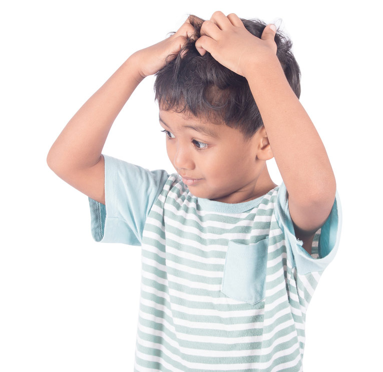 Alopecia Mucinosa Primary alopecia mucinosa is mostly found in children.