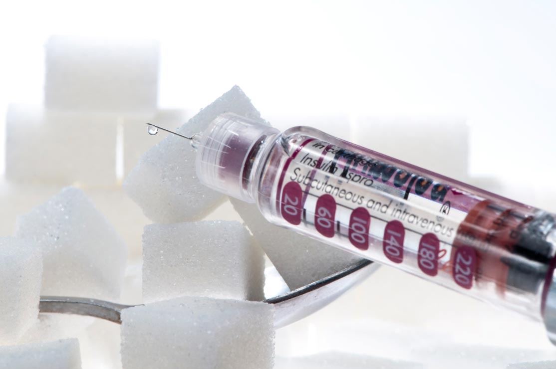 Insulin for Diabetes thinning_hair_diabetes_insulin