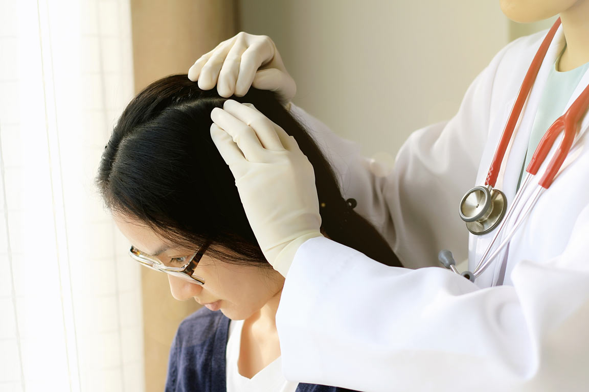 Seborrheic Dermatitis & Hair Loss Seborrheic dermatitis can lead to hair loss.